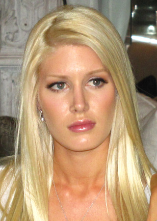 heidi montag plastic surgery before and after pictures. hot Heidi Montag#39;s plastic
