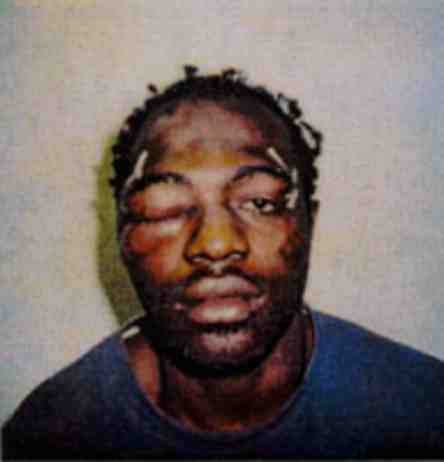 Rodney King's mugshot from March 1991