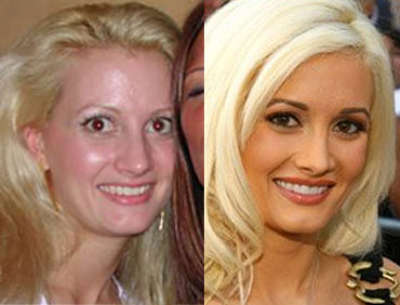 Holly Madison before and after her plastic surgery episodes